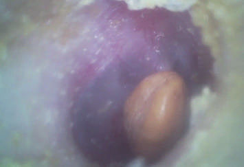 Draagbare ENT Werkingsgebied Economische Handbediende Digitale Videooorspiegel met Micro- BR Flitskaart van 32G