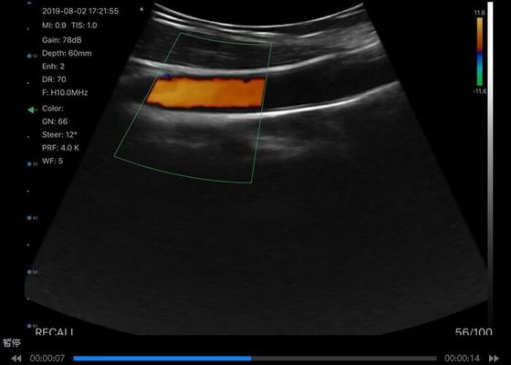 Digitale draadloze handheld ultrasound scanner