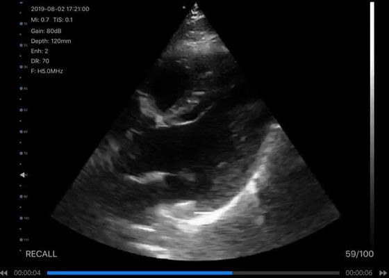 Digitale draadloze handheld ultrasound scanner
