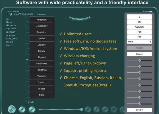 Digitale draadloze handheld ultrasound scanner