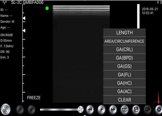 5G handbediende Convexe Ultrasone klankscanner: Lineair 3.5~5MHz: Hart 7.5~10MHz: 2.5~5MHz