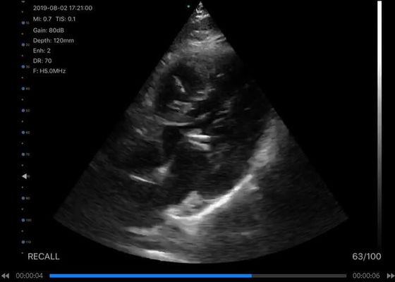 5G handbediende Convexe Ultrasone klankscanner: Lineair 3.5~5MHz: Hart 7.5~10MHz: 2.5~5MHz