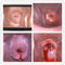 Vaginale Camera Digitale Elektronische Colposcope om Ziekte van Cervix Eealier te vinden