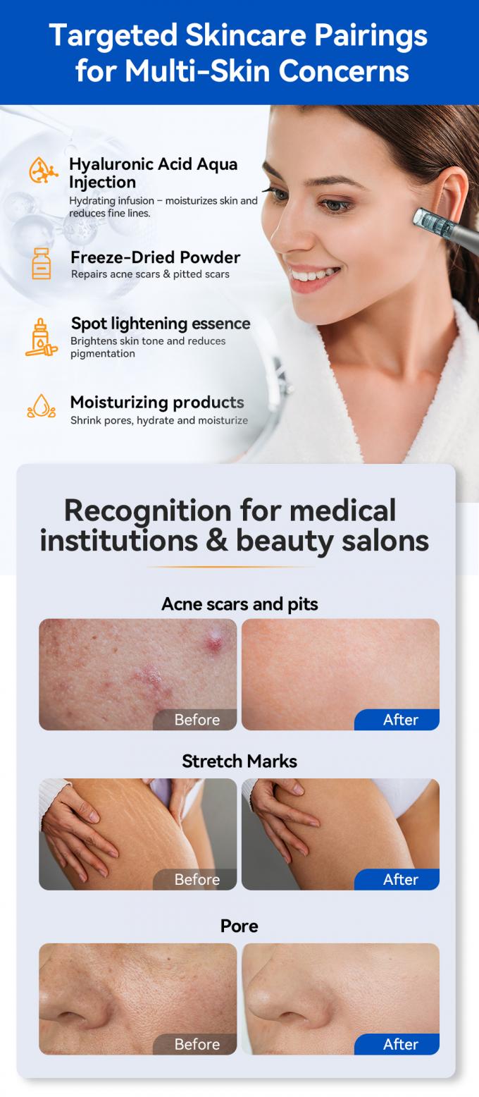 MTS Hydra Pen H5 Microneedle Derma Pen Populair anti-aging huidverzorgingsapparaat Gezicht Huidverjonging Whitening Collagen Therapie 7