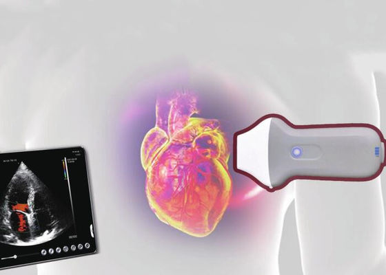 Draadloze Draagbare de Ultrasone klankscanner 128 van PDI WiFi Element